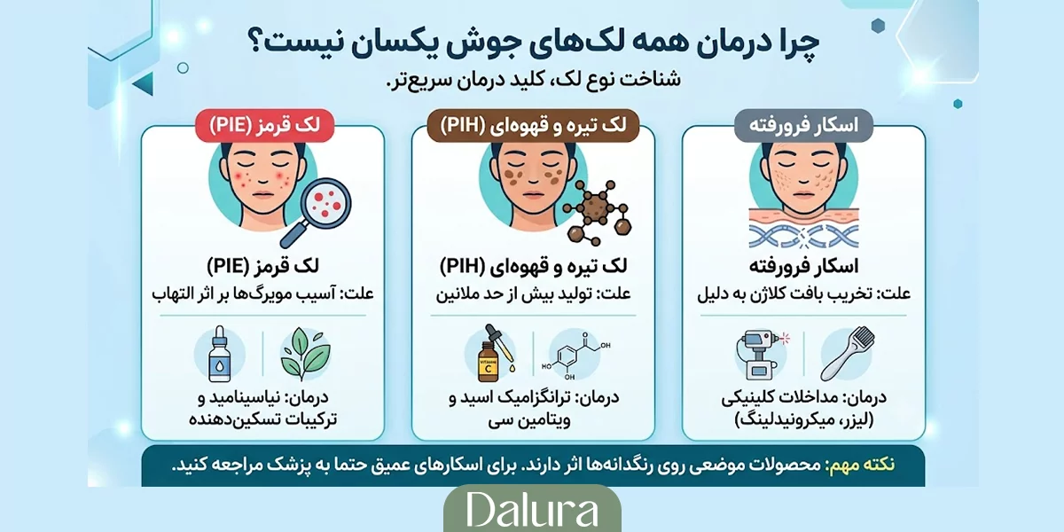 آیا در درمان خانگی جوش همه لک‌ها به‌صورت یکسان درمان می‌شوند؟