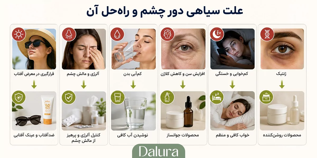 علت سیاهی دور چشم